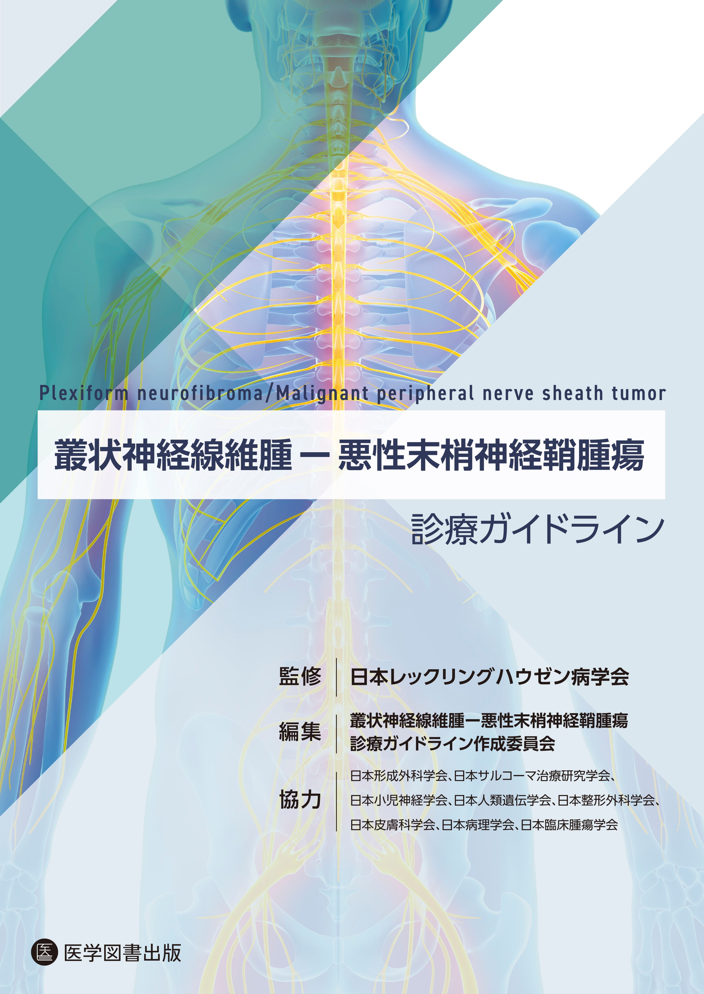 叢状神経線維腫―悪性末梢神経鞘腫瘍 診療ガイドライン – 医学図書出版